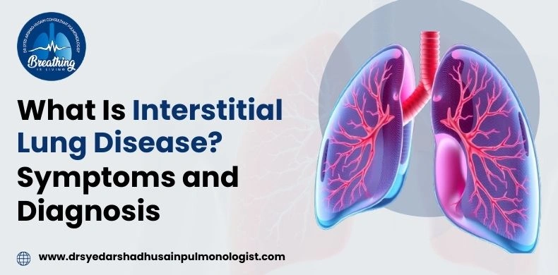 What Is Interstitial Lung Disease? Symptoms and Diagnosis