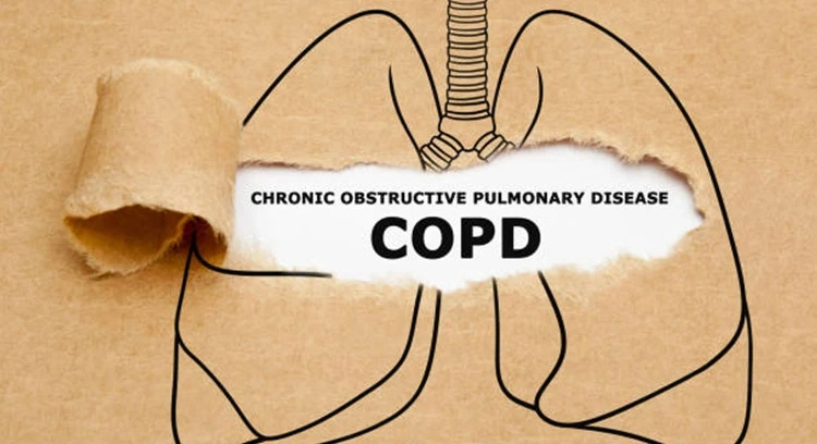 (COPD)